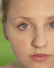 Allgemeine Dermatologie